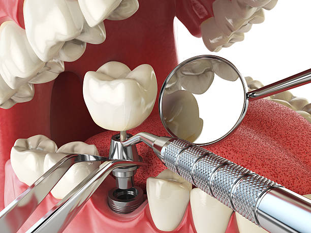 Best Weekend Emergency Dental Services in Owings Mills, MD